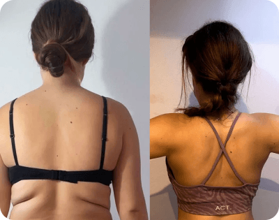 Maria before and after