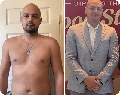 Mark before and after